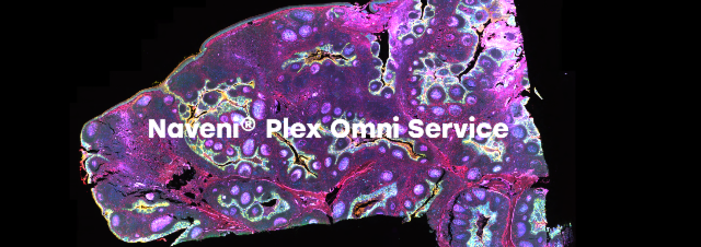 Interactions protéine-protéine - Service Naveni® Plex Omni 