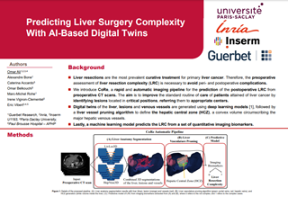POSTER INRIA : Predicting Liver Surgery Complexity With AI-Based Digital Twins